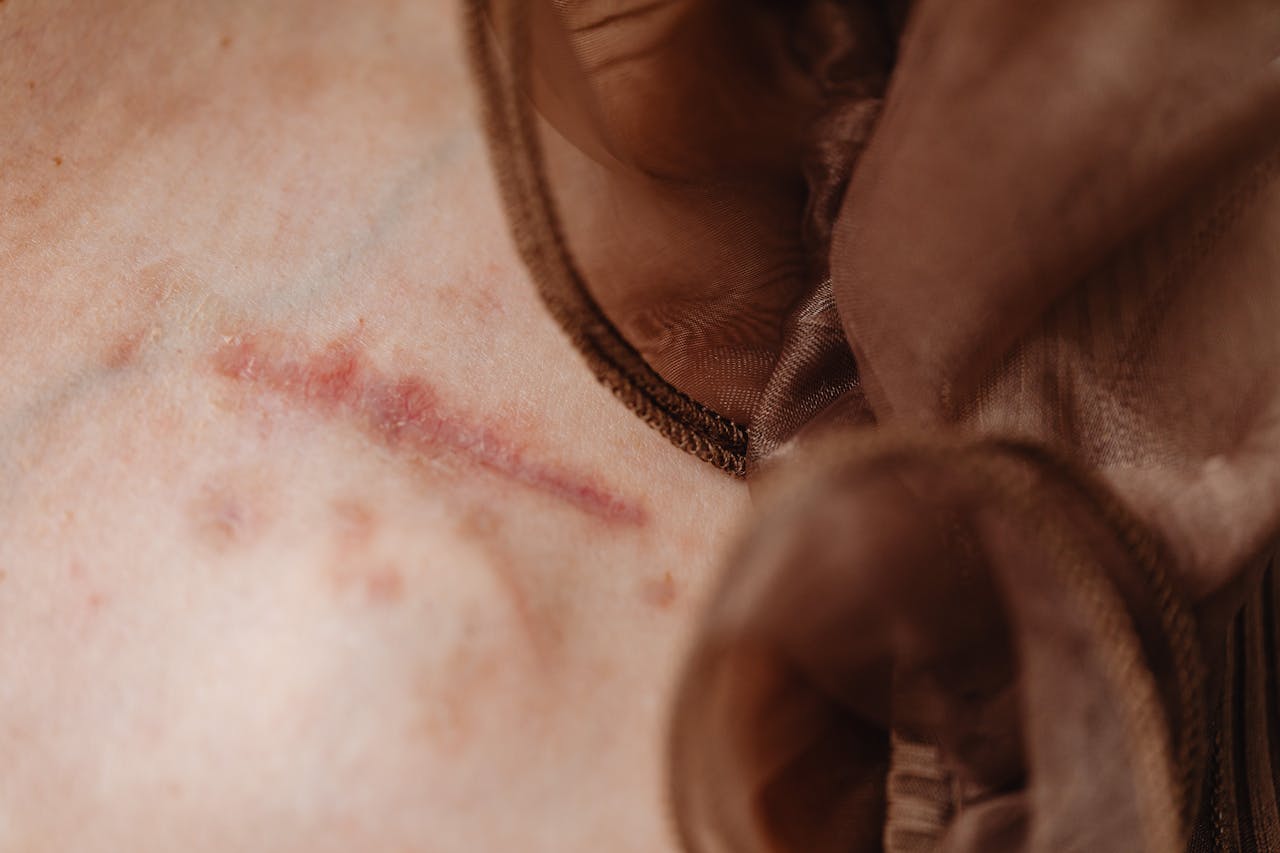 Detailed close-up of human skin revealing a surgical scar, skin texture, and fabric detail.